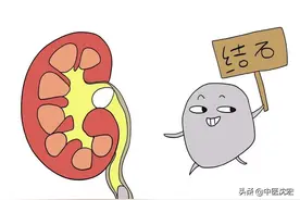 结石反反复复？一个中成药解毒排石，清浊利湿，改善结石体质图片