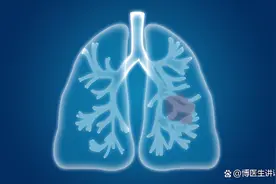 肺部有病，先看痰液，提醒：若出现4种颜色的痰，建议检查肺CT图片