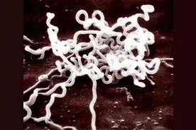 去洗浴中心洗澡，会感染梅毒？图片