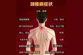 早晨醒来双手发胀，握不拢，几分钟后就正常了，是怎么回事？图片