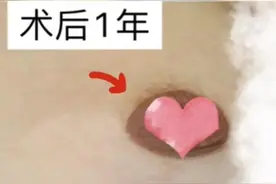 “乳房缩小上提手术”痕迹明显吗？会不会有很严重的瘢痕？图片