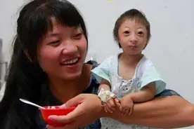 2009年，湖南女子生下“猴孩”，马戏团花5万抱走，女子：做梦！图片