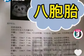 18岁女孩怀上8胞胎：乱用促排卵药，多胞胎来了也保不住图片