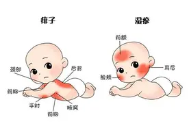 天气越来越热了，小宝宝‬‬长痱子怎么办？图片