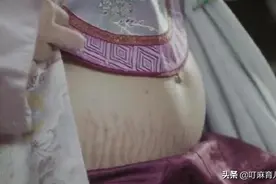 孕中晚期，孕妇身上这个表现，可能是“妊娠纹”的前兆图片