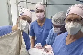 生命神奇！巴西女婴出生时仍裹在羊膜囊内，概率仅8万分之一图片