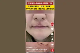 多家媒体爆料脱毛膏致癌！脱毛膏还能用吗？图片