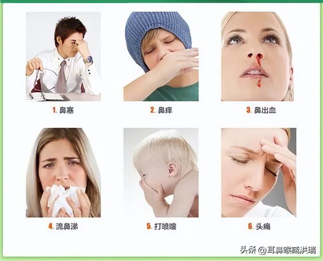 鼻科知识汇：有过敏性鼻炎，复方薄荷滴鼻液可以长期使用吗？
