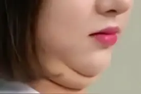双下巴是怎么来的？如何改善？图片