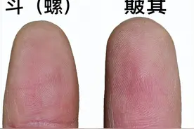 人类指纹的斗和簸算，真的是基因诅咒？难道每个人的未来早已注定图片