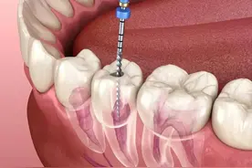 大家闻风丧胆的“抽神经”，到底是种什么体验？图片