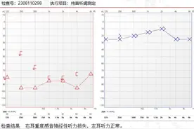 严重突发性耳聋是怎么治愈的，看看这些图就明白了图片