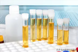 体内有病，小便先知？尿液出现这3种颜色，或是你的身体正在求救图片