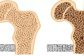 上了年纪，觉得腿脚无力、使不上劲？多半是缺乏营养，要学会补图片
