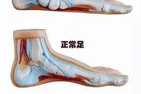 2023年征兵报名火热进行中！体检常见问题解答（外科篇）图片