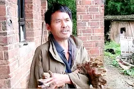 故事：湖南小伙患怪病20多年，被误判鱼痣后，四肢长出枯树枝条图片