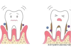 牙医告诉你哪些牙齿需要拔图片