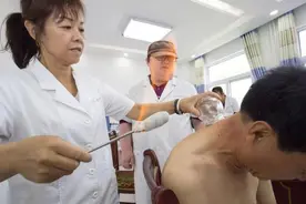 拔罐能排毒吗？拔罐后的黑印到底是什么？现在知道还不晚图片