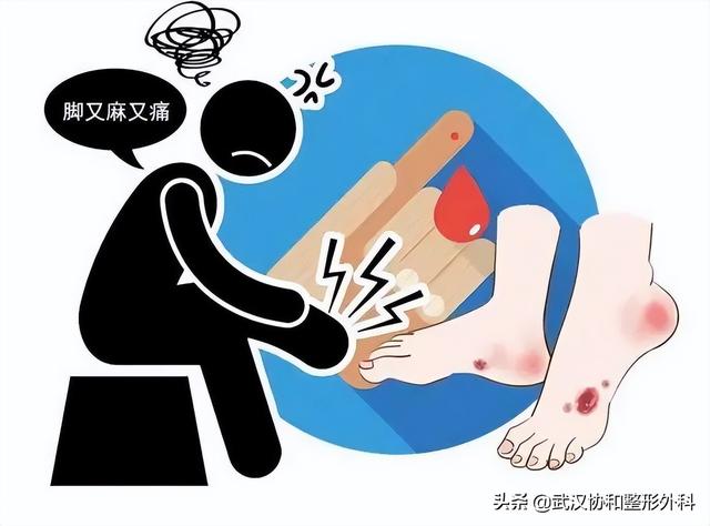 足底过度角化名词解释