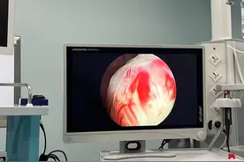 70岁大伯憋尿憋出肾积水，看完你还敢憋尿吗？图片