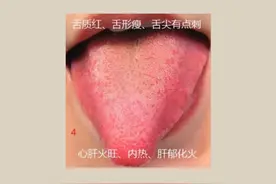 脾胃虚弱的原因是什么？中医告诉你，对照看看你是哪一种？图片