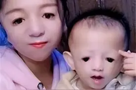 “鸟脸”妈妈不听劝阻拼二胎，现如今3岁儿子外貌遗传，智力受损图片