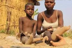 非洲的一个奇特部落，族人脚上都只有两个脚趾，就像鸵鸟爪子图片