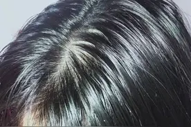 多久洗一次头比较健康？正确洗头，这些方法每个人都应该知道图片