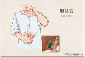 三次急性胰腺炎并住进了ICU，起因仅仅是......图片