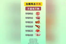 白癜风总不消，不能吃6物图片