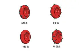 血型与老年痴呆有关，研究揭秘“痴呆血型”，你是什么型？图片
