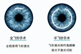 想告别眼镜，近视手术到底怎么选？图片