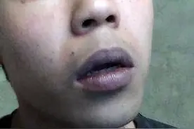 嘴唇出现这4种颜色，说明要养脾了，教你4个中成药，健脾养脾图片