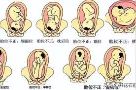 低头出生和仰头出生有区别吗？屁股比头要小，先出不是更容易？图片