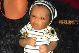 怀了双胞胎，最后却只有一个孩子？原来是一个“吃”掉了另一个图片