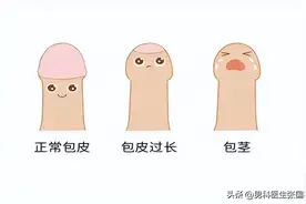 包皮长一定要割掉吗？NO，除非你有一些特殊情况图片