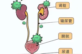 十种用于治疗尿路感染的中成药图片