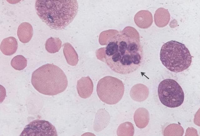 几块钱一瓶维生素B12，或许可以“摆平”这五种病，早了解早受益