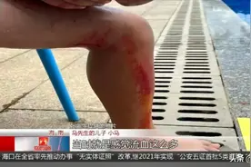 10岁男孩酒店泳池游泳受伤，涉事泳池属外包，无证经营被关停图片