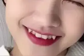 为什么正畸医生不建议拔掉虎牙？原来虎牙如此重要！图片