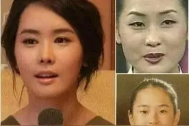 世界四大“邪术”之韩国整容术图片