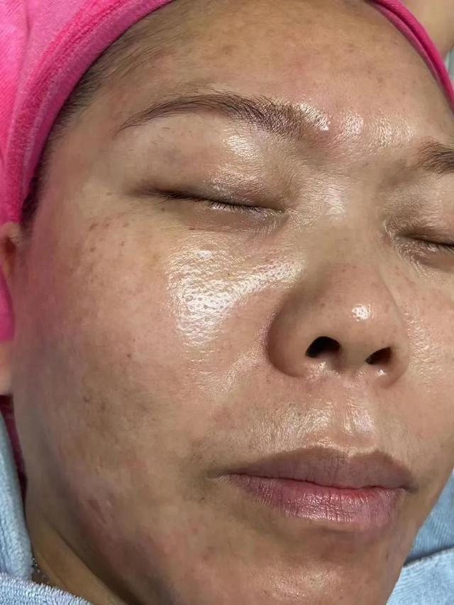 涔版姢鑲ゅ搧涓嶆噦寰楃湅鎴愬垎琛紝浼氬悆浜忓悧锛? onerror=