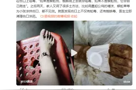 女孩被蛇咬伤奶奶抓蜘蛛吸毒 ：致其“毒上加毒”图片