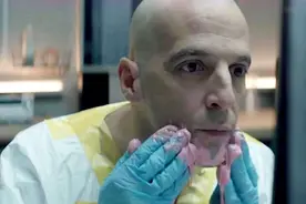 中国科学家曾为猴子换头，20小时后执行安乐死，究竟因为什么？图片