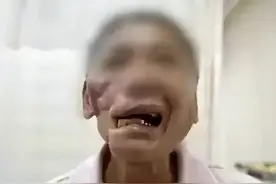 槟榔，到底是如何让你上瘾的？图片