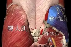 臀部和下肢疼痛？可能是梨状肌的问题图片