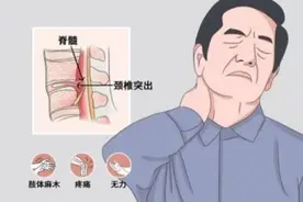 这套颈椎保健操每天练起来图片