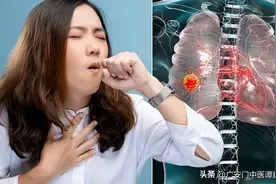 肺癌咳嗽特点是什么？咳嗽白色泡沫痰是肺癌吗？图片