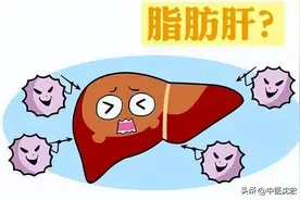 脂肪肝的根源在痰和瘀，一盒中成药，化痰降浊，专治脂肪肝图片