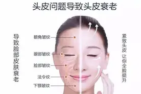 头皮也要抗衰老！原来头皮才是面部衰老的罪魁祸首图片